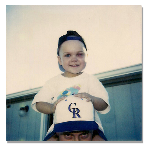 Brock's Birthday Party - 3 yrs old. Photo Brock Walquist with his eye sewn shut.